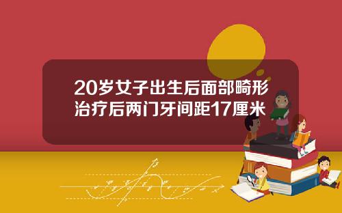 20岁女子出生后面部畸形治疗后两门牙间距17厘米