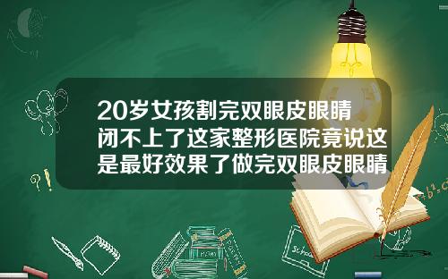 20岁女孩割完双眼皮眼睛闭不上了这家整形医院竟说这是最好效果了做完双眼皮眼睛闭不住怎么办